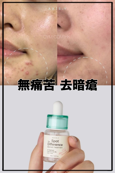 AXIS-Y 特效暗瘡護理液 Spot The Disfference Blemish Treatment
